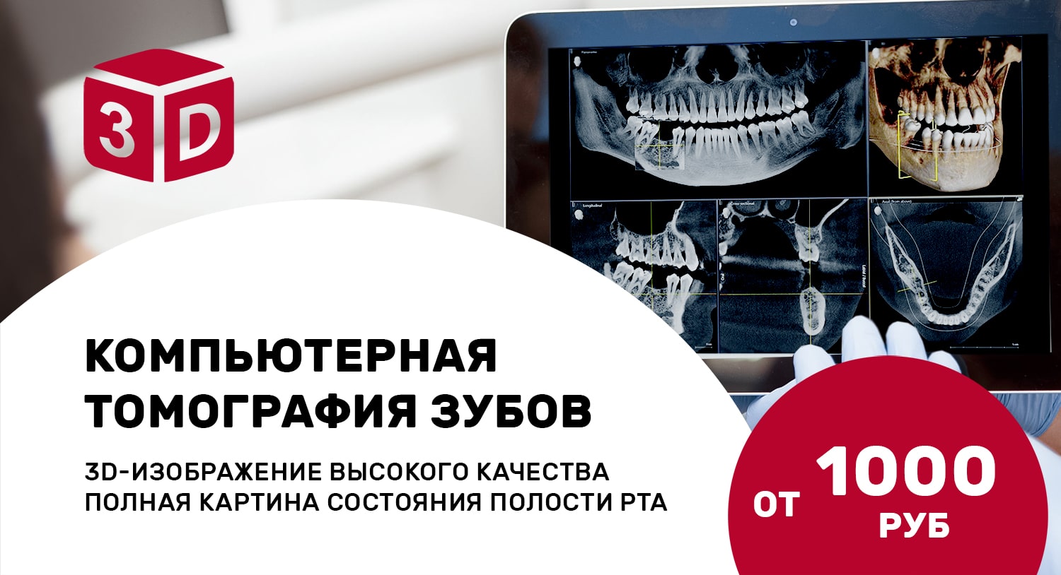 preimushchestva-kompyuternoy-tomografii-zubov-min